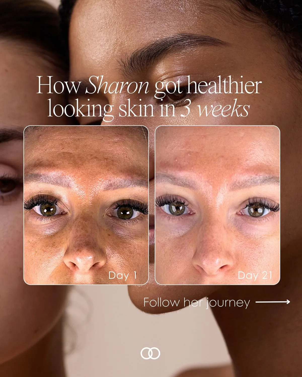 Phác đồ kết hợp Retinol và Repair Ampoule của SRX