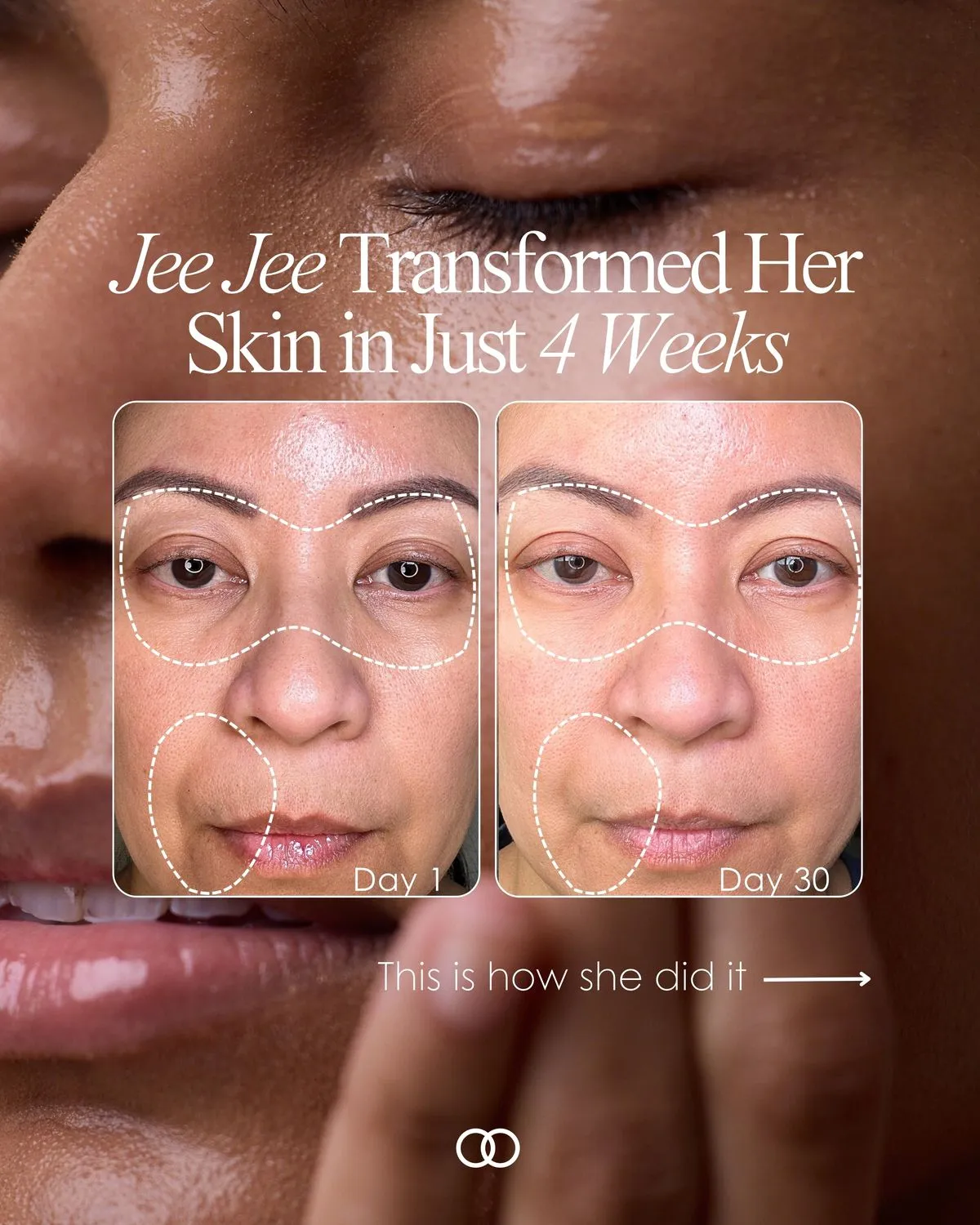 Phác đồ kết hợp Retinol và Repair Ampoule của SRX